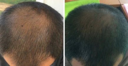 Regrow-Hair-in-10-Days-Proof-3.jpg